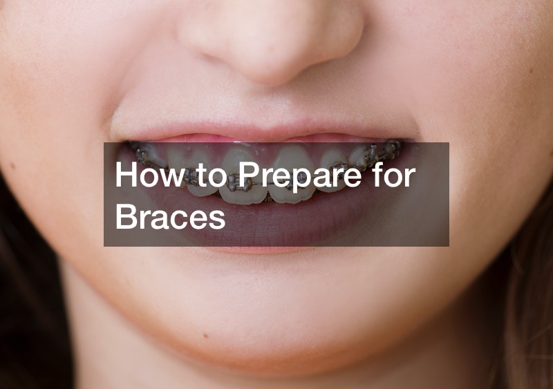 How to Prepare for Braces